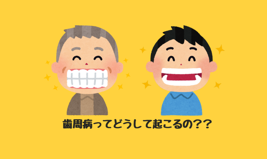 歯周病ってどうして起こるの？？